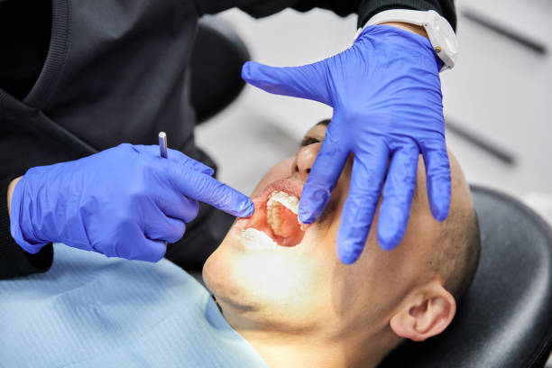 Best Dentist for Tooth Abscess  in Carrollton, MO
